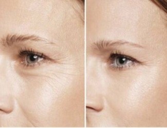 提前衰老、抵抗力差，用熟三七粉，抗衰還能補氣血！